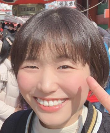 古賀紗理奈　歯の矯正　八重歯